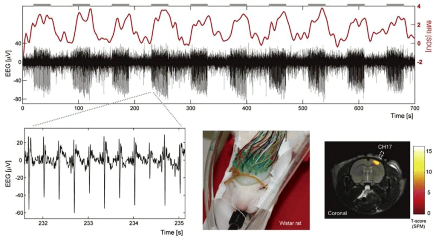 Rat EEG and fMRI